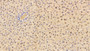 DAB staining on IHC-P; Sample: Rat Liver Tissue; Primary Ab: 30ug/ml Mouse Anti-Human GSTa1 Antibody Second Ab: 2ug/mL HRP-Linked Caprine Anti-Mouse IgG Polyclonal Antibody