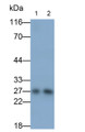 Western Blot; Samples: Lane1: Rat Serum; Lane2: Mouse Serum; Primary Ab: 0.1ug/ml Rabbit Anti-Mouse CRP Antibody Second Ab: 0.2ug/ml HRP-Linked Caprine Anti-Rabbit IgG Polyclonal Antibody