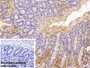 DAB staining on IHC-P; Sample: Porcine Small intestine Tissue; Primary Ab: 10ug/ml Rabbit Anti-Human AT Antibody; Control: Used PBS instead of primary antibody; Second Ab: 2ug/ml HRP-Linked Caprine Anti-Rabbit IgG Polyclonal Antibody