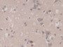 DAB staining on IHC-P; Sample: Human Cerebrum Tissue; Primary Ab: 30ug/ml Mouse Anti-Human TGFb3 Antibody Second Ab: 2ug/mL HRP-Linked Caprine Anti-Mouse IgG Polyclonal Antibody