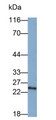 Western Blot; Sample: PC3 cell lysate Primary Ab: 0.5ug/ml Mouse Anti-Human PSMD10 Antibody Second Ab: 0.2ug/mL HRP-Linked Caprine Anti-Mouse IgG Polyclonal Antibody