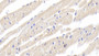 DAB staining on IHC-P; Samples: Rabbit Cardiac Muscle Tissue; Primary Ab: 20ug/ml Cavia Anti-Rabbit IL18 Antibody Second Ab: 2ug/mL HRP-Linked Rabbit Anti-Cavia IgG Polyclonal Antibody