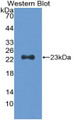 Western Blot; Sample: Recombinant TNNI1, Mouse.