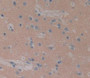 Used in DAB staining on fromalin fixed paraffin- embedded Kidney tissue