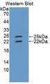 Western Blot; Sample: Recombinant IFNg, Human.