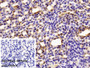 DAB staining on IHC-P; Sample: Mouse Kidney Tissue; Primary Ab: 10ug/ml Rabbit Anti-Mouse SUMO2 Antibody; Control: Used PBS instead of primary antibody; Second Ab: 2ug/ml HRP-Linked Caprine Anti-Rabbit IgG Polyclonal Antibody
