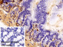 DAB staining on IHC-P; Sample: Mouse Colon Tissue; Primary Ab: 10ug/ml Rabbit Anti-Mouse SUMO2 Antibody; Control: Used PBS instead of primary antibody; Second Ab: 2ug/ml HRP-Linked Caprine Anti-Rabbit IgG Polyclonal Antibody