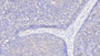 DAB staining on IHC-P; Sample: Human Lymph node Tissue; Primary Ab: 20ug/ml Rabbit Anti-Human INHA Antibody Second Ab: 2ug/mL HRP-Linked Caprine Anti-Rabbit IgG Polyclonal Antibody