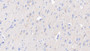 DAB staining on IHC-P; Sample: Porcine Cerebrum Tissue; Primary Ab: 30ug/ml Rabbit Anti-Multi-species NEFL Antibody; Second Ab: 2ug/mL HRP-Linked Caprine Anti-Rabbit IgG Polyclonal Antibody