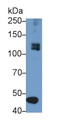 Western Blot; Sample: Human Placenta lysate Primary Ab: 1ug/ml Mouse Anti-Human SCFR Antibody Second Ab: 0.2ug/mL HRP-Linked Caprine Anti-Mouse IgG Polyclonal Antibody