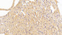 DAB staining on IHC-P; Sample: Rat Cardiac Muscle Tissue; Primary Ab: 30ug/ml Mouse Anti-Rat SFRP1 Antibody Second Ab: 2ug/mL HRP-Linked Caprine Anti-Mouse IgG Polyclonal Antibody