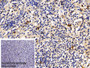 DAB staining on IHC-P; Sample: Human Spleen Tissue; Primary Ab: 30ug/ml Mouse Anti-Human CD38 Antibody; Control: Used PBS instead of primary antibody; Second Ab: 2ug/ml HRP-Linked Caprine Anti-Mouse IgG Polyclonal Antibody