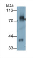 Western Blot; Sample: Human Cartilage lysate; Primary Ab: 0.2ug/ml Mouse Anti-Human POSTN Antibody; Second Ab: 0.2ug/ml HRP-Linked Caprine Anti-Mouse IgG Polyclonal Antibody