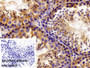 DAB staining on IHC-P; Sample: Mouse Testis Tissue; Primary Ab: 10ug/ml Rabbit Anti-Human PKM2 Antibody; Control: Used PBS instead of primary antibody; Second Ab: 2ug/ml HRP-Linked Caprine Anti-Rabbit IgG Polyclonal Antibody