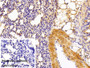 DAB staining on IHC-P; Sample: Mouse Lung Tissue; Primary Ab: 10ug/ml Rabbit Anti-Human PKM2 Antibody; Control: Used PBS instead of primary antibody; Second Ab: 2ug/ml HRP-Linked Caprine Anti-Rabbit IgG Polyclonal Antibody