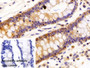 DAB staining on IHC-P; Sample: Porcine Colon Tissue; Primary Ab: 10ug/ml Rabbit Anti-Human CK19 Antibody; Control: Used PBS instead of primary antibody; Second Ab: 2ug/ml HRP-Linked Caprine Anti-Rabbit IgG Polyclonal Antibody