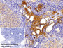 DAB staining on IHC-P; Sample: Rat Ovary Tissue Primary Ab: 10ug/ml Rabbit Anti-Rat FPA Antibody Control: Used PBS instead of primary antibody Second Ab: 2ug/ml HRP-Linked Caprine Anti-Rabbit IgG Polyclonal Antibody