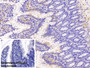 DAB staining on IHC-P; Sample: Rat Colon Tissue; Primary Ab: 10ug/ml Rabbit Anti-Rat FPA Antibody; Control: Used PBS instead of primary antibody; Second Ab: 2ug/ml HRP-Linked Caprine Anti-Rabbit IgG Polyclonal Antibody