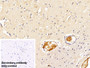 DAB staining on IHC-P; Sample: Rabbit Cerebrum Tissue Primary Ab: 30ug/ml Mouse Anti-Rabbit IgG Antibody Control: Used PBS instead of primary antibody Second Ab: 2ug/ml HRP-Linked Caprine Anti-Mouse IgG Polyclonal Antibody