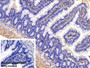 DAB staining on IHC-P; Sample: Rat Colon Tissue Primary Ab: 30ug/ml Mouse Anti-Human ACTC1 Antibody Control: Used PBS instead of primary antibody Second Ab: 2ug/ml HRP-Linked Caprine Anti-Mouse IgG Polyclonal Antibody
