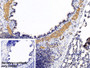 DAB staining on IHC-P; Sample: Rat Lung Tissue; Primary Ab: 30ug/ml Mouse Anti-Human ACTC1 Antibody; Control: Used PBS instead of primary antibody; Second Ab: 2ug/ml HRP-Linked Caprine Anti-Mouse IgG Polyclonal Antibody