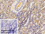 DAB staining on IHC-P; Sample: Porcine Kidney Tissue; Primary Ab: 10ug/ml Rabbit Anti-Human PARK7 Antibody; Control: Used PBS instead of primary antibody; Second Ab: 2ug/ml HRP-Linked Caprine Anti-Rabbit IgG Polyclonal Antibody