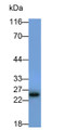 Western Blot; Sample: Raji cell lysate; Primary Ab: 0.2ug/ml Mouse Anti-Human CD79B Antibody; Second Ab: 0.2ug/ml HRP-Linked Caprine Anti-Mouse IgG Polyclonal Antibody