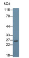 Western Blot; Sample: Raji cell lysate; Primary Ab: 0.1ug/ml Mouse Anti-Human CD79B Antibody; Second Ab: 0.2ug/ml HRP-Linked Caprine Anti-Mouse IgG Polyclonal Antibody
