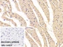 DAB staining on IHC-P; Sample: Rat Cardiac Muscle Tissue; Primary Ab: 10ug/ml Rabbit Anti-Rat H-FABP Antibody; Control: Used PBS instead of primary antibody; Second Ab: 2ug/ml HRP-Linked Caprine Anti-Rabbit IgG Polyclonal Antibody