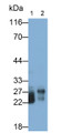 Western Blot; Samples: Lane1: Porcine Pancreas lysate; Lane2: Rat Pancreas lysate; Primary Ab: 0.05ug/ml Rabbit Anti-Gallus TRY Antibody; Second Ab: 0.2ug/ml HRP-Linked Caprine Anti-Rabbit IgG Polyclonal Antibody