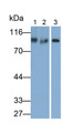 Western Blot; Samples: Lane1: Mouse Cerebrum lysate; Lane2: Rat Cerebrum lysate; Lane3: Hela cell lysate; Primary Ab: 0.1ug/ml Rabbit Anti-Human CAPN7 Antibody; Second Ab: 0.2ug/ml HRP-Linked Caprine Anti-Rabbit IgG Polyclonal Antibody