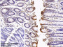 DAB staining on IHC-P; Sample: Porcine Colon Tissue; Primary Ab: 10ug/ml Rabbit Anti-Porcine LAMR1 Antibody; Control: Used PBS instead of primary antibody; Second Ab: 2ug/ml HRP-Linked Caprine Anti-Rabbit IgG Polyclonal Antibody