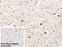 DAB staining on IHC-P; Sample: Porcine Cerebrum Tissue; Primary Ab: 10ug/ml Rabbit Anti-Porcine LAMR1 Antibody; Control: Used PBS instead of primary antibody; Second Ab: 2ug/ml HRP-Linked Caprine Anti-Rabbit IgG Polyclonal Antibody
