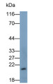 Western Blot; Sample: THP1 cell lysate; Primary Ab: 0.2ug/ml Mouse Anti-Human IL18 Antibody; Second Ab: 0.2ug/ml HRP-Linked Caprine Anti-Mouse IgG Polyclonal Antibody
