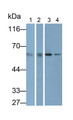 Western Blot; Samples: Lane1: Rat Liver lysate; Lane2: Rat Kidney lysate; Lane3: Hela cell lysate; Lane4: HepG2 cell lysate; Primary Ab: 0.2ug/ml Mouse Anti-Human CAT Antibody; Second Ab: 0.2ug/ml HRP-Linked Caprine Anti-Mouse IgG Polyclonal Antibody