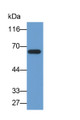 Western Blot; Sample: Hela cell lysate; Primary Ab: 0.2ug/ml Mouse Anti-Human SQSTM1 Antibody; Second Ab: 0.2ug/ml HRP-Linked Caprine Anti-Mouse IgG Polyclonal Antibody