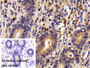 DAB staining on IHC-P; Sample: Porcine Uterus Tissue; Primary Ab: 10ug/ml Rabbit Anti-Porcine SDC1 Antibody; Control: Used PBS instead of primary antibody; Second Ab: 2ug/ml HRP-Linked Caprine Anti-Rabbit IgG Polyclonal Antibody
