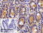 DAB staining on IHC-P; Sample: Porcine Small intestine Tissue; Primary Ab: 10ug/ml Rabbit Anti-Porcine SDC1 Antibody; Control: Used PBS instead of primary antibody; Second Ab: 2ug/ml HRP-Linked Caprine Anti-Rabbit IgG Polyclonal Antibody