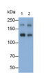 Western Blot; Samples: Lane1: Porcine Cerebrum lysate; Lane2: Porcine Cerebellum lysate; Primary Ab: 0.01ug/ml Mouse Anti-Human L1CAM Antibody; Second Ab: 0.2ug/ml HRP-Linked Caprine Anti-Mouse IgG Polyclonal Antibody