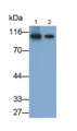 Western Blot; Samples: Lane1: Rat Liver lysate; Lane2: Rat Cerebrum lysate; Primary Ab: 0.2ug/ml Mouse Anti-Rat PYGL Antibody; Second Ab: 0.2ug/ml HRP-Linked Caprine Anti-Mouse IgG Polyclonal Antibody