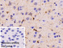 DAB staining on IHC-P; Sample: Rat Cerebrum Tissue; Primary Ab: 30ug/ml Mouse Anti-Rat CK-BB Antibody; Control: Used PBS instead of primary antibody; Second Ab: 2ug/ml HRP-Linked Caprine Anti-Mouse IgG Polyclonal Antibody