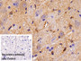 DAB staining on IHC-P; Sample: Rat Spinal cord Tissue; Primary Ab: 30ug/ml Mouse Anti-Rat CK-BB Antibody; Control: Used PBS instead of primary antibody; Second Ab: 2ug/ml HRP-Linked Caprine Anti-Mouse IgG Polyclonal Antibody