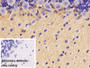 DAB staining on IHC-P; Sample: Rat Cerebellum Tissue; Primary Ab: 30ug/ml Mouse Anti-Rat CK-BB Antibody; Control: Used PBS instead of primary antibody; Second Ab: 2ug/ml HRP-Linked Caprine Anti-Mouse IgG Polyclonal Antibody