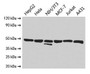 Western Blot; Positive WB detected in: HepG2 whole cell lysate, Hela whole cell lysate, NIH/3T3 whole cell lysate, MCF-7 whole cell lysate, Jurkat whole cell lysate, A431 whole cell lysate; All lanes: ENO1 antibody at 2.5µg/ml; Secondary; Goat polyclonal to rabbit IgG at 1/10000 dilution; Predicted band size: 48, 37 kDa; Observed band size: 48 kDa