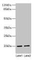Western blot; All lanes: COX4I1 antibody at 10µg/ml; Lane 1: Rat muscle tissue; Lane 2: Zebrafish lysate; Secondary; Goat polyclonal to rabbit IgG at 1/10000 dilution; Predicted band size: 20 kDa; Observed band size: 20 kDa