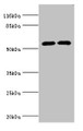 Western blot; All lanes: CYP2E1 antibody at 12µg/ml; Lane 1: Jurkat whole cell lysate; Lane 2: Mouse liver tissue; Secondary; Goat polyclonal to rabbit IgG at 1/10000 dilution; Predicted band size: 57 kDa; Observed band size: 57 kDa