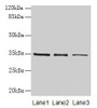 Western blot; All lanes: GDF15 antibody at 4µg/ml; Lane 1: HepG2 whole cell lysate; Lane 2: Human placenta tissue; Lane 3: A549 whole cell lysate; Secondary; Goat polyclonal to rabbit IgG at 1/10000 dilution; Predicted band size: 35 kDa; Observed band size: 35 kDa