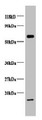 Western blot; All lanes: COX5B antibody at 2µg/ml + EC109 whole cell lysate; Secondary; Goat polyclonal to rabbit IgG at 1/15000 dilution; Predicted band size: 14 kDa; Observed band size: 14, 65 kDa Western blot; All lanes: COX5B antibody at 2µg/ml + EC109 whole cell lysate; Secondary; Goat polyclonal to rabbit IgG at 1/15000 dilution; Predicted band size: 14 kDa; Observed band size: 14, 65 kDa