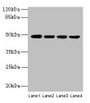Western blot; All lanes: INHBA antibody at 2µg/ml; Lane 1: Hela whole cell lysate; Lane 2: HepG2 whole cell lysate; Lane 3: A549 whole cell lysate; Lane 4: MCF-7 whole cell lysate; Secondary; Goat polyclonal to rabbit IgG at 1/10000 dilution; Predicted band size: 48 kDa; Observed band size: 48 kDa