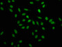 Immunofluorescence staining of Hela cells with CAC07236 at 1:100, counter-stained with DAPI. The cells were fixed in 4% formaldehyde, permeabilized using 0.2% Triton X-100 and blocked in 10% normal Goat Serum. The cells were then incubated with the antibody overnight at 4°C. The secondary antibody was Alexa Fluor 488-congugated AffiniPure Goat Anti-Rabbit IgG(H+L).